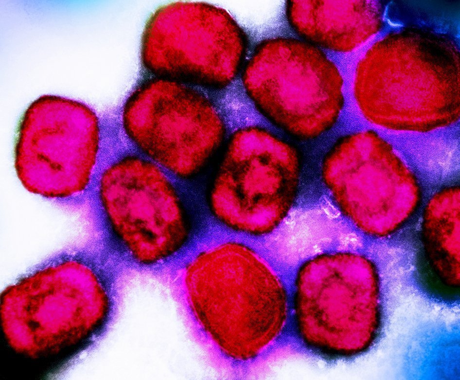 Mpox : la fin de l’urgence sanitaire, mais une vigilance qui reste de mise